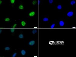 Histone H3, p Thr6 Antibody, Novus Biologicals 0.025mg; Unlabeled:Antibodies,